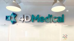 Faktor Pendorong Kenaikan Saham 4DMedical Hari Ini